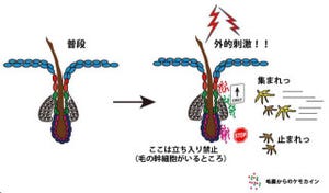 毛はただの物理的バリアではない - 慶応大、毛嚢の免疫に関する機能を発見