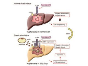 横浜市立大など、非アルコール性脂肪肝炎の起きるメカニズムを解明