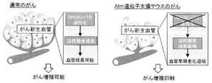 慶応大、細胞の大敵「活性酸素」でがんを兵糧攻めにする治療戦略を発表