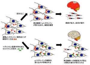 パーキンソン病とその類縁疾患には「セルトラリン」が有効 - 東北大が確認