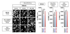 東北大、糖尿病網膜症の「網膜神経節細胞死」の進行を遅らせることに成功