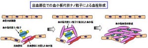 防衛医科大など、大量出血でも止血可能な「血小板代替物ナノ粒子」を開発