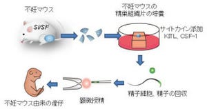 精子形成障害型の男性不妊の治療に光明 - 横浜市立大などがマウスで実証