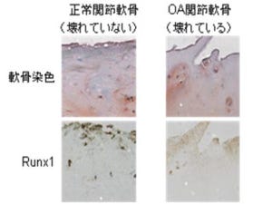 東大、変形性関節症の根本治療につながる低分子化合物とその作用機序を解明