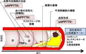 理研、急性心筋梗塞の早期診断用の新規バイオマーカー候補を発見