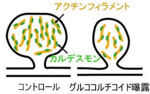 岩手医科大、ストレスによるシナプス形成障害の分子メカニズムを解明