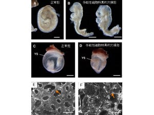 理研、多能性細胞の分化・増殖には遺伝子「Vps52」が重要であることを発見