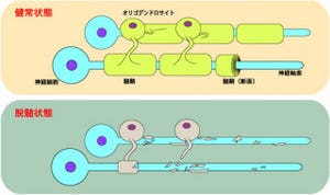 NIBBなど、脳の「髄鞘」の形成・再形成には酵素「Ptprz」が関連と解明