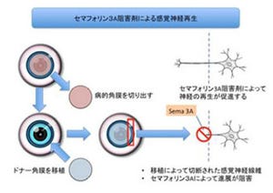 慶応大など、セマフォリン3A阻害剤による角膜の感覚神経再生にマウスで成功