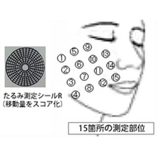 ほうれい線の原因はフェイスラインのたるみ -ロート、たるみ量測定法を開発