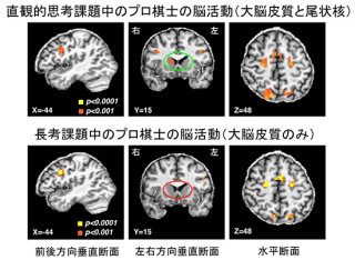 プロ棋士らが持つ直観的思考は脳の「尾状核」の活動と関連あり - 理研など