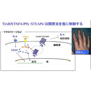 筑波大、関節リウマチの発症と治療効果に関わるタンパク質分子を発見