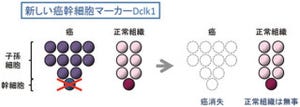 京大、「がん幹細胞」マーカーとして遺伝子「Dclk1」を同定