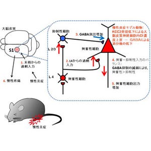 生理研、S1の興奮-抑制バランス破綻が慢性疼痛に関与することを確認