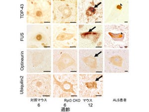 京大、遺伝子改変マウスで「筋萎縮性側索硬化症」の疾患の再現に成功