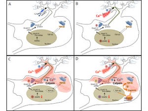 東大など、筋萎縮性側索硬化症(ALS)の原因メカニズムを解明