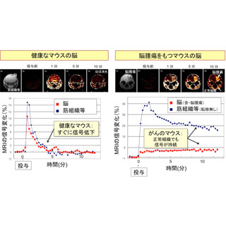 放医研、フリーラジカルから身を守る能力を可視化する技術を開発