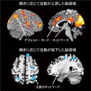 ヒトはまばたきのたびに脳領域の活動を切り換えている - 阪大が解明