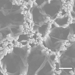 理研、血液検査だけで血中のがん細胞のモニタリングを可能とする技術を開発