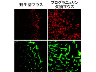 「プログラニュリン」は脳のミクログリアの過剰な活性化を抑制する - 東大