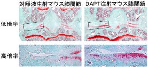 東大、変形性膝関節症をNotch阻害剤「DAPT」の注射で予防できることを確認