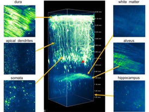 北大など、生きたままのマウスの脳を世界で最も深く観察できる顕微鏡を開発