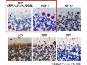 転写因子「HSF-1」がSBMAの異常タンパク質の蓄積を減少させた  -名大など