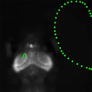 遺伝研、脳に映る視覚世界をリアルタイムで観察することに成功