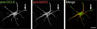 脳の発達障害の関連分子がシナプス形成とその形成過剰を抑制 - 東大