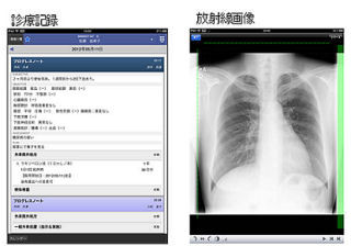 富士通、モバイル端末で電子カルテを院外から閲覧できる製品発売