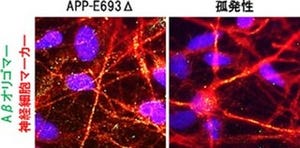 アルツハイマー病、患者のiPS細胞で病態解明