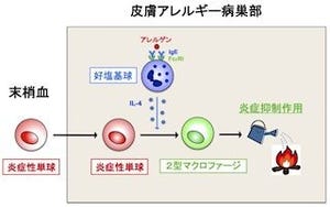 アレルギーの火付け役を火消し役に変換することで炎症を抑制 - TMDUなど