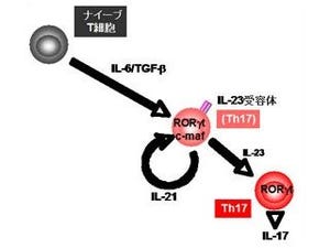 NCNP、「多発性硬化症」発症の仕組みを解明 - 病態改善の手がかりを発見