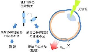 理研など、近視と難聴の合併症の原因となる遺伝子変異を発見