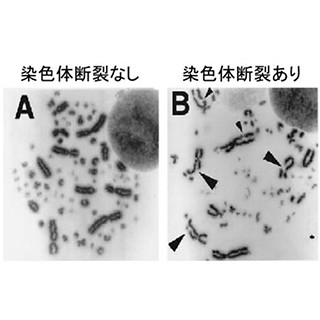 被爆線量測定法「染色体検査法」の原理は常に正しいわけではない-京大が確認