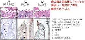 東大など、「テノモジュリン」が「歯周靭帯」の発生などに関わると発表