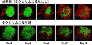 免疫抑制剤タクロリムスが「すい島」移植のマイナス要因だった - 東北大