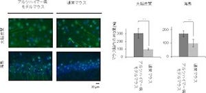 アミロイドβの凝集を防ぐには「ヒト型プレフォルディン」がカギ - 理研