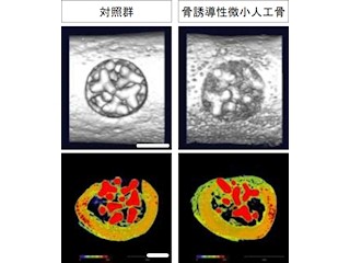 東大、滅菌可能な「骨誘導性微小人工骨」を開発