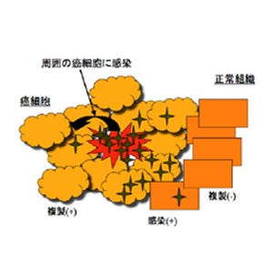 東大、再燃前立腺がんに対するヘルペスウイルス療法の臨床研究を開始