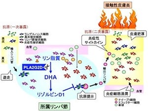 東京都医学研など、脂質成分が炎症にブレーキをかける仕組みを解明