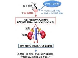 岡山大、治療薬のなかった「クッシング病」にメラトニンが有効と究明