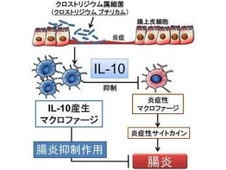 慶応大など、消化管内の細菌が大腸の炎症を抑制していることを発見