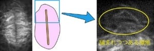 NIBBなど、分裂時の植物細胞内の仕切りができる様子を高解像度で撮影