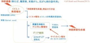 福岡大など、「神経障害性疼痛」の発現にケモカイン「CCL-1」の関与を証明