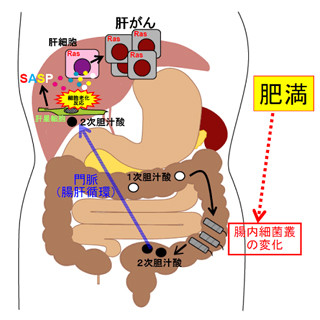 なぜ肥満になると肝がんなどの発症率が上昇するのか - がん研が機構を解明