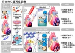 慶応大など、iPS細胞なしの心臓線維芽細胞→心筋様細胞の作製技術を開発