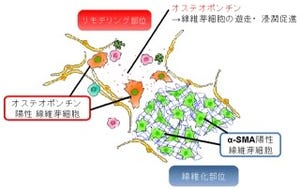 東大など、「肺線維症」をもたらすメカニズムの一端を解明