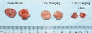 慶応大、薬剤耐性のある前立腺がんを抗がん剤の効く体質にする薬を発見