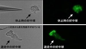 九大、「好中球」が病原菌に向かって真直ぐに遊走する仕組みを解明